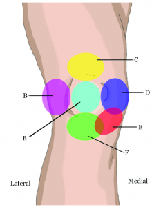 Location of Knee Pain