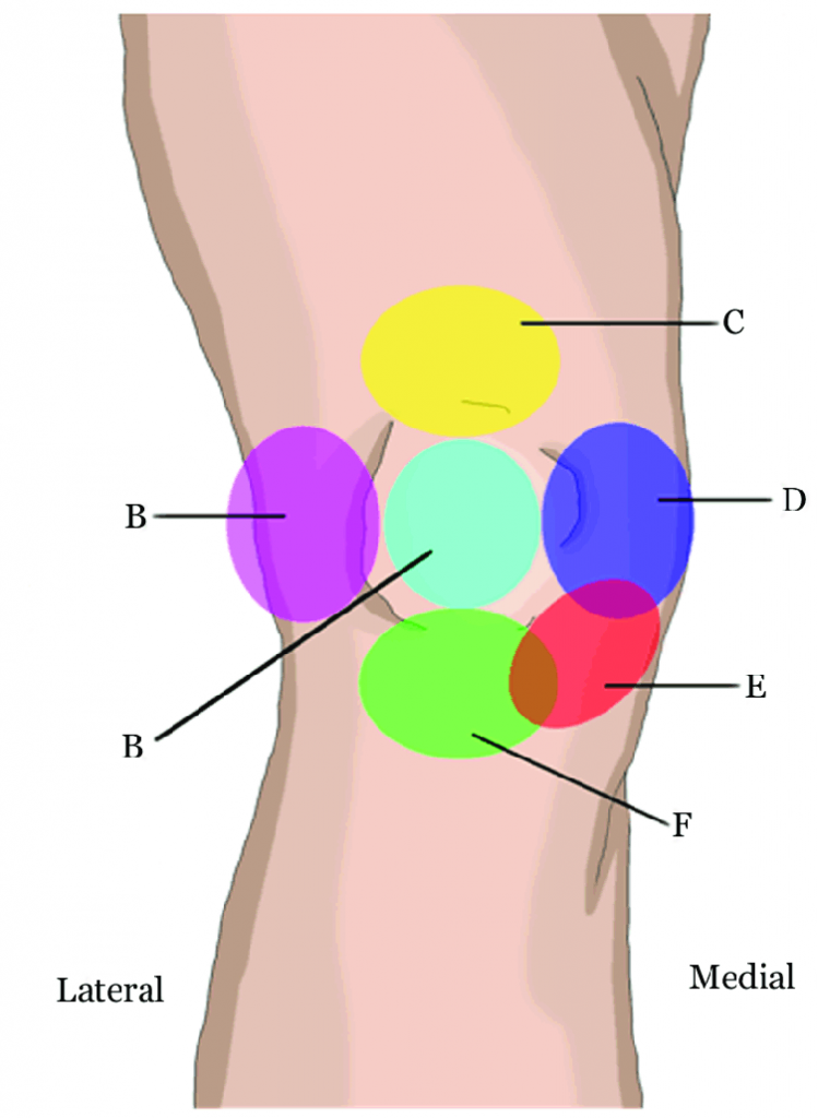 Self Diagnosing Knee Pain | Vancouver Chiropractic Care