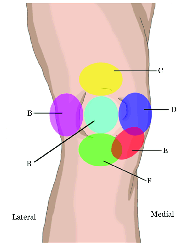 Self Diagnosing Knee Pain