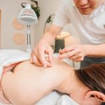 Acupuncture